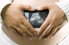 怀孕做B超要多少钱？