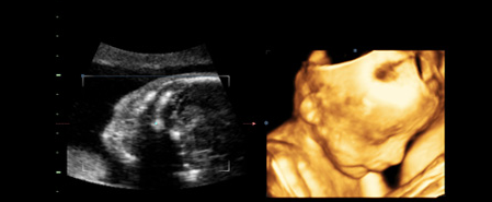 做三维彩超多少钱