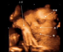 三维彩超全攻略