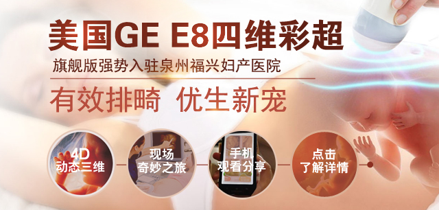 四维彩超检查时间是什么时候