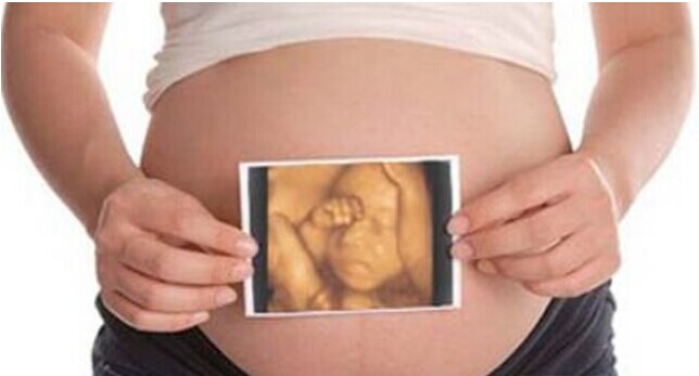 怀孕多久做四维彩超