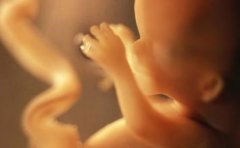 泉州三维彩超费用要多少