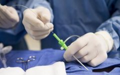 输卵管造影检查需要多长时间?