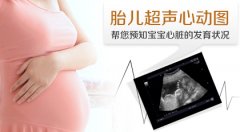 胎儿心脏彩超百科全解