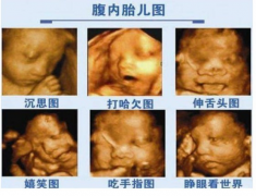 四维彩超有话要对孕妈妈说