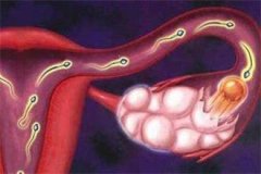 女人卵巢保养远离这些误区